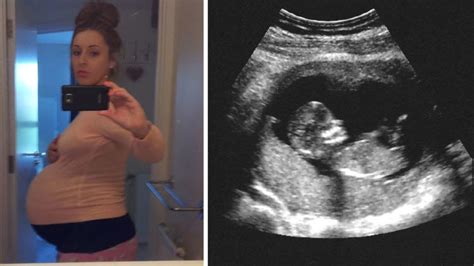 Surrogates Belly Keeps Growing Then Doctor Spots Something Unusual In