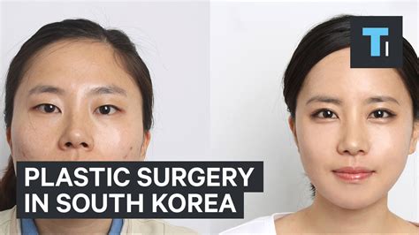 Plastic Surgery In South Korea Youtube