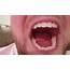 LONGEST UVULA OUT THERE  YouTube