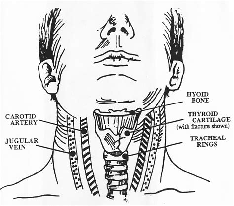 Neck Anatomy Diagram Sagittal Section Of The Head And Neck Clipart Etc