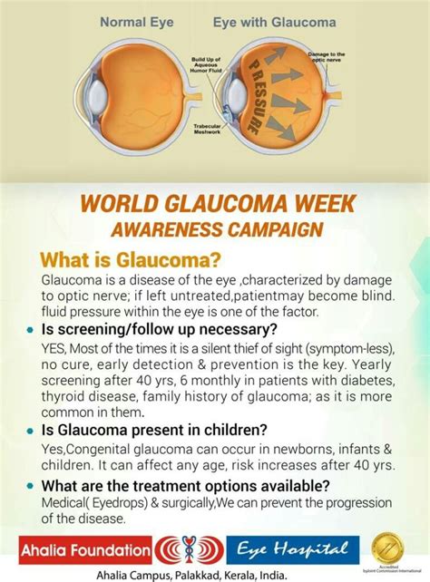Glaucoma Ahalia Foundation Eye Hospital Kannur