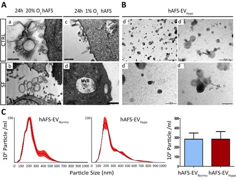 Human amniotic fluid stem cells secrete exosomes endowed with