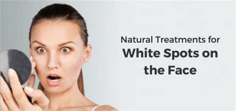 11 Natural Remedies To Get Rid Of White Spots On The Face