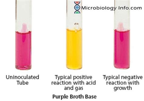 Oxidation Fermentation Test