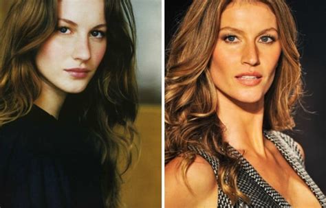 Gisele Bundchen Before And After Plastic Surgery Nose Job Boobs