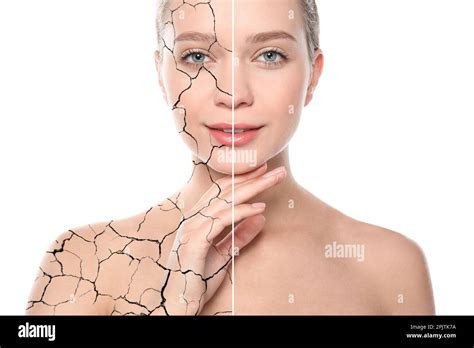 Collage With Photos Of Woman Having Dry Skin Problem Before And After