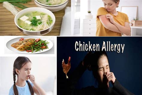 Chicken Allergy Definition Symptoms Risk Factors And More