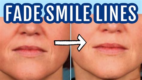 12 Ways To Fade Smile Lines Nasolabial Folds Dr Dray Youtube