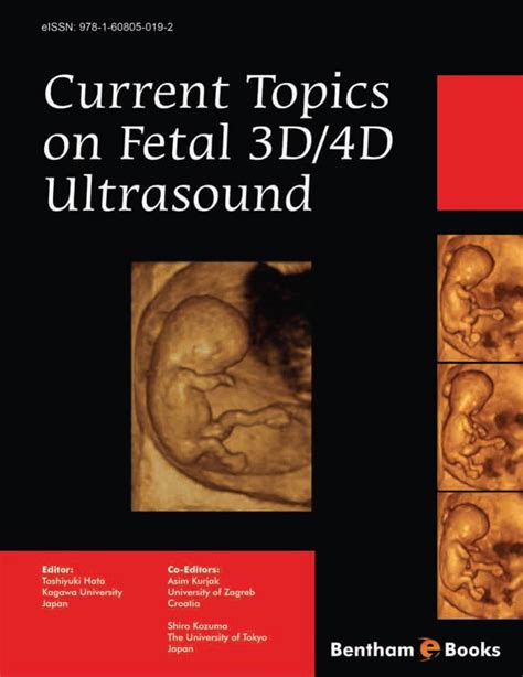 Current Topics On Fetal 3d4d Ultrasound