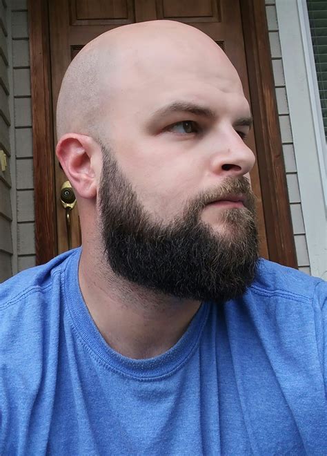 I Had A Pretty Sizeable Yeard 5 6 Inches Up Until This Last Weekend