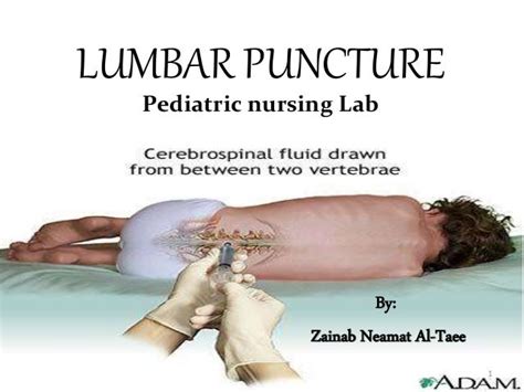 Pediatric Lumbar Puncture