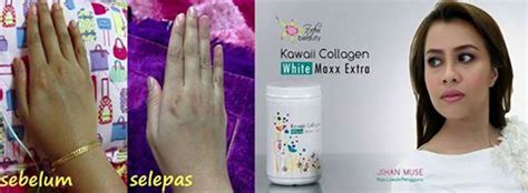 October 18, 2014fazilahrahmanshoppe leave a comment. Secret Skin White Kawaii Collagen / Skincare Kawaii Dr ...