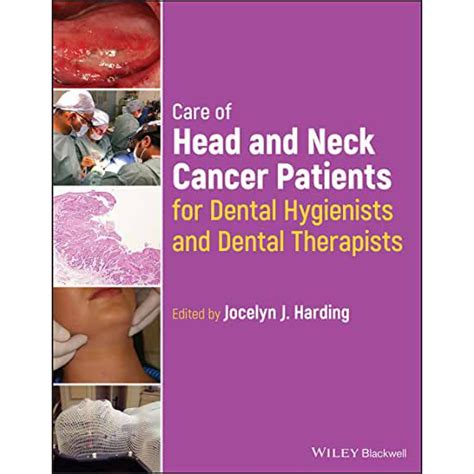 Care Of Head And Neck Cancer Patients For Dental Hygienists And Dental Therapists 2023