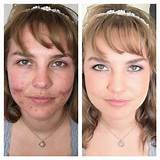 Airbrush Makeup Before And After Pictures