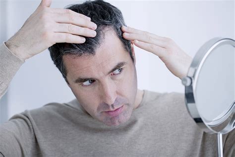 Male Hair Loss Why Do Men Lose Hair As They Get Older Vivo Clinic