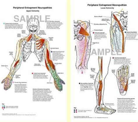 Peripheral Entrapment Neurapathy Charts