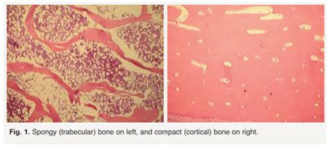 Spongy Vs Compact Bone Histology