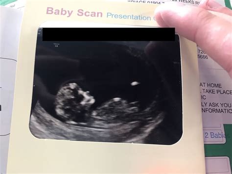 Pregnancy Diary Week 12 Part 1 The First Scan Rebel Angel