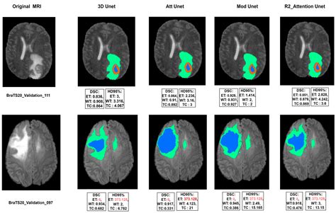 Diagnostics Free Full Text U Net Based Models Towards Optimal MR Brain Image Segmentation