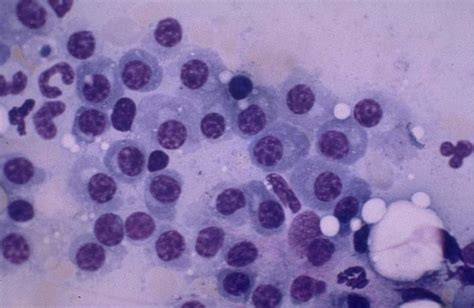 Skin Plasmacytoma In Dogs Canis Vetlexicon