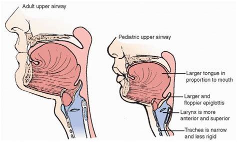 Pediatric Airway Anatomy Differences Anatomy Structure