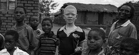 A bit of black hair, black eyebrows, black eyelashes, dark eyes. Killed for their bones - On the trail of the trade in ...