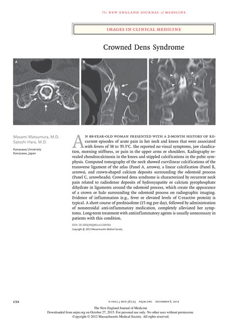 Pdf Crowned Dens Syndrome