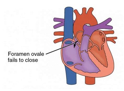 Heart Anatomy Bio103 Human Biology