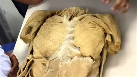 Chest muscles anatomy drawing : Anatomy Lab - 3 - Chest Muscles - YouTube