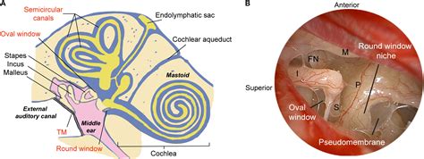 Enlarged Anatomical Model Of Labyrinthine Cochlear Inner Ear Of Human