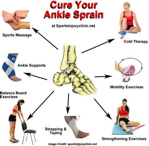 Ankle Sprain Cause Symptoms And Treatment Sprain Treatment