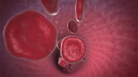 Fda Approves Two Powerful New Treatments For Sickle Cell Disease