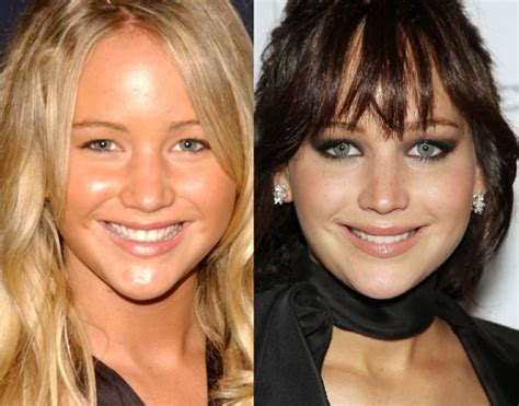 15 celebrities you didn t realise have had plastic surgery