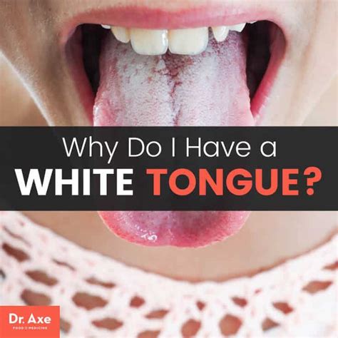 Why Do I Have A White Tongue Your Bodys Trying To Tell You Something