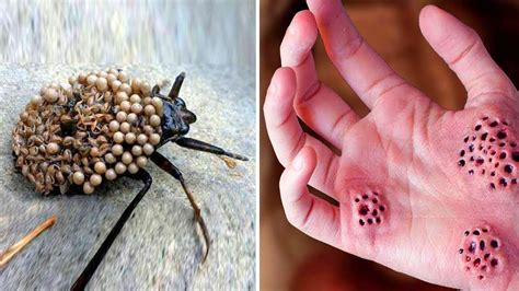 12 Most Painful Animal Stings You Can Experience 