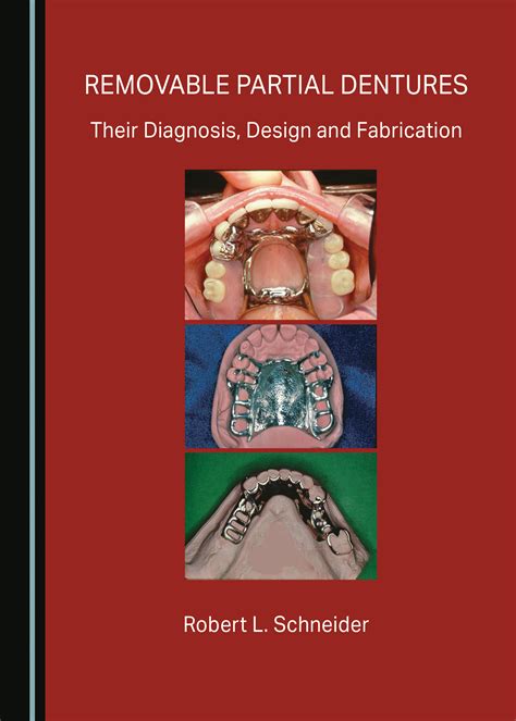 Removable Partial Dentures Their Diagnosis Design And Fabrication
