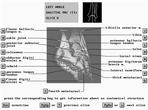 The muscles are located mainly in the sole of the foot and divided into a central (medial) group and a group on either side (lateral). MRI ANKLE NORMAL ANATOMY Dr/AHMED EISAWY - YouTube