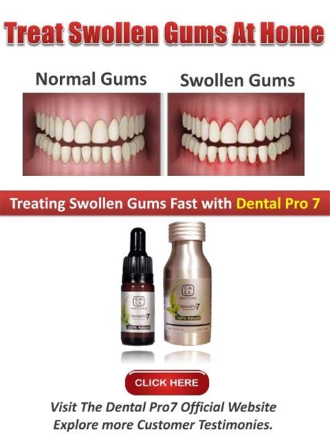 Swollen Gums Around Tooth Home Remedy