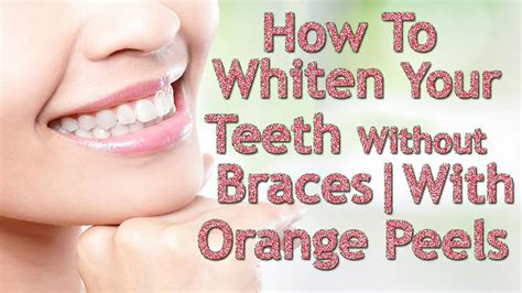 This is even more relevant in terms of keeping the teeth white. How To Whiten Your Teeth Without Braces Easily| Very Shiny ...