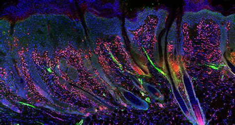 Single Cell Rna Seq Uncovers Genetic Factor That Enables Adult Skin To