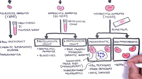 Anaemia Anemia Classification Microcytic Normocytic And