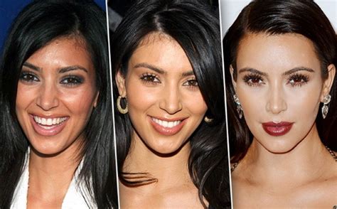 Before And After Plastic Surgery Stunning Transformations