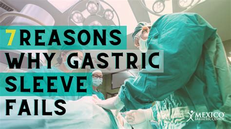 Gastric Sleeve Fails Archives Mexico Bariatric Center