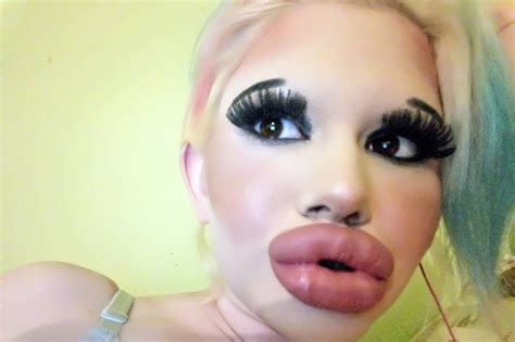 Woman Who Wants ‘biggest Lips In The World’ Has 15 Procedures To Be Fashionable Daily Star