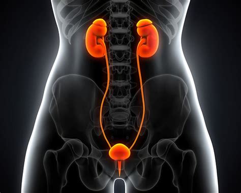 Kidney Cysts Urologist Uc Irvine Department Of Urology