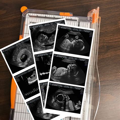 Fake Ultrasound Pictures Fake sonogram Prank Ultrasound | Etsy