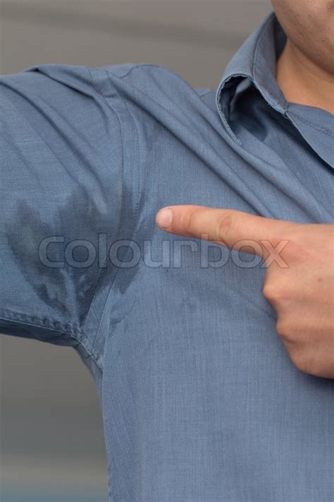 Man With Hyperhidrosis Sweating Very Stock Image Colourbox