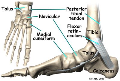 Physical Therapy In California South Bay For Accessory Navicular Problems