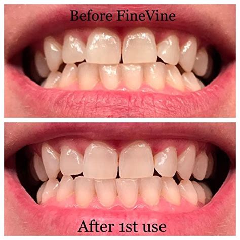 100 Natural Charcoal Teeth Whitening Toothpaste Charcoal Toothpaste