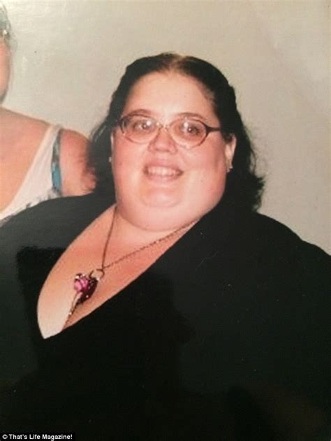220kg Australian Woman Lost Half Body Weight But Is Left With 20kg